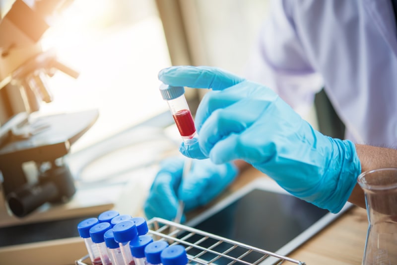 Why Us - Blood Testing